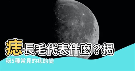 痣長毛代表什麼|【痣長毛 代表什麼】痣長毛代表什麼？醫師解析痣毛象徵與5大痣。